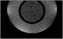0 mm holes vertically and horizontally. UL Spatial Resolution Matrix: Registration with Phantom Resolution Holes 1.