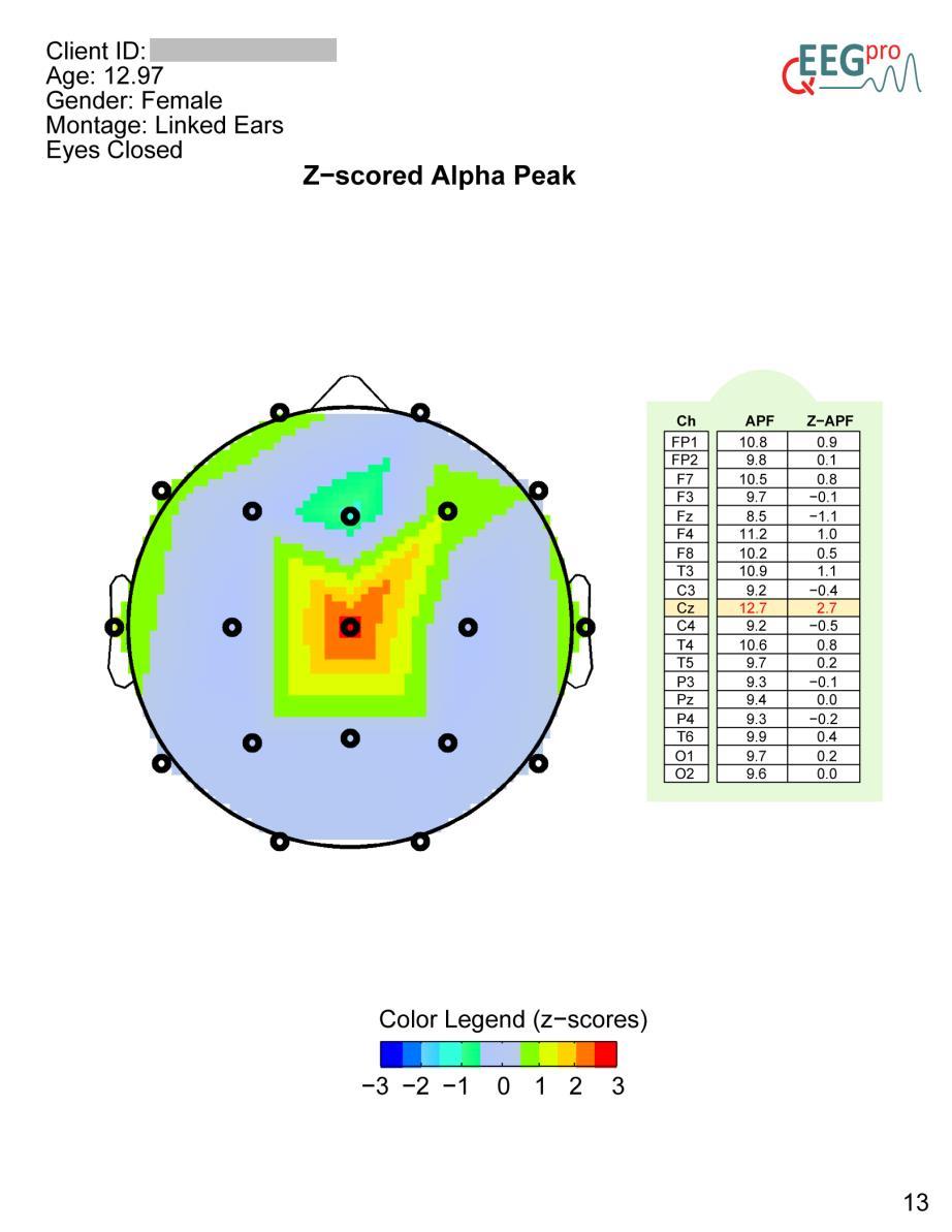 9. Z-scored Alpha peak In section 8 of the qeeg-pro report, a topoplot is depicted, showing the z-scores of the APF.