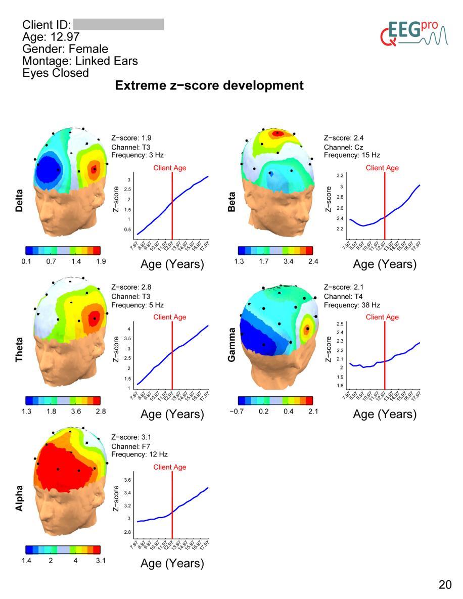 14. Extreme Z-score Development Section 13 of the qeeg-pro report contains the results of the extreme z-score development analysis.