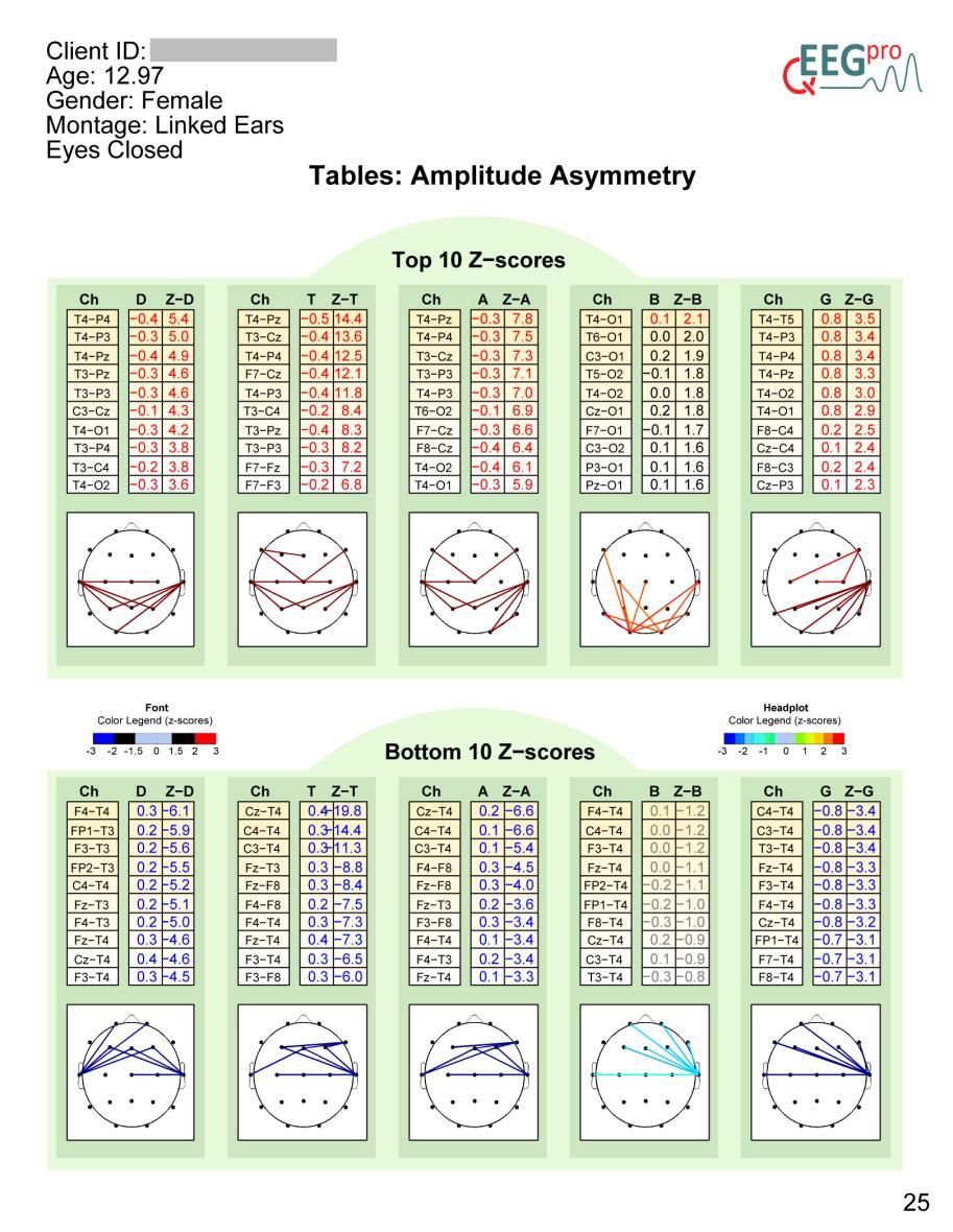 18. Tables: Amplitude Asymmetry Section 17 of the qeeg-pro report shows two tables containing the top and bottom 10 Amplitude Asymmetry data and the z-scored Amplitude Asymmetry, for 4 frequency