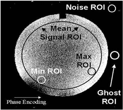 Measuring coil SNR Method 2: SNR = 0.