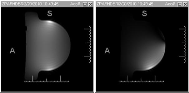 Coronal image Sagittal composite image Noise