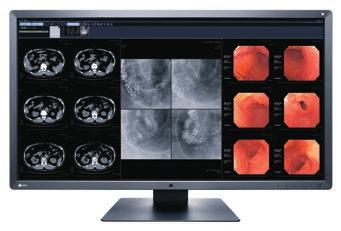 By utilizing the MX315W's increased viewing space and freedom of layout, it is possible to display various inspection images side by side, such as CT and MRI images in tiled format.