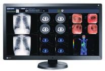 Multi-Modality Monitors With advances in medical imaging technology over the years, hospitals are now handling a wider variety and larger volume of image data.