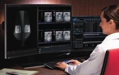 Full Color Support With a maximum brightness of 1100 cd/m 2 and a contrast ratio of 1500:1, the RX560 can display high-definition monochrome breast tomosynthesis and mammography images with deep
