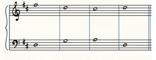 HC (H) Bb: I IV V Once students have spent time embellishing melodies of cadence patterns, they can move on to the second exercise