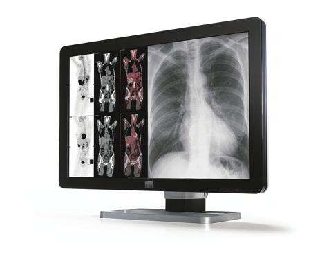 fatigue Increased demand for radiology Coronis 6MP and MediCal QAWeb Diagnostic accuracy Enhanced productivity Increased revenue Optimizing Performance and Workflow with a Multi-Modality Display