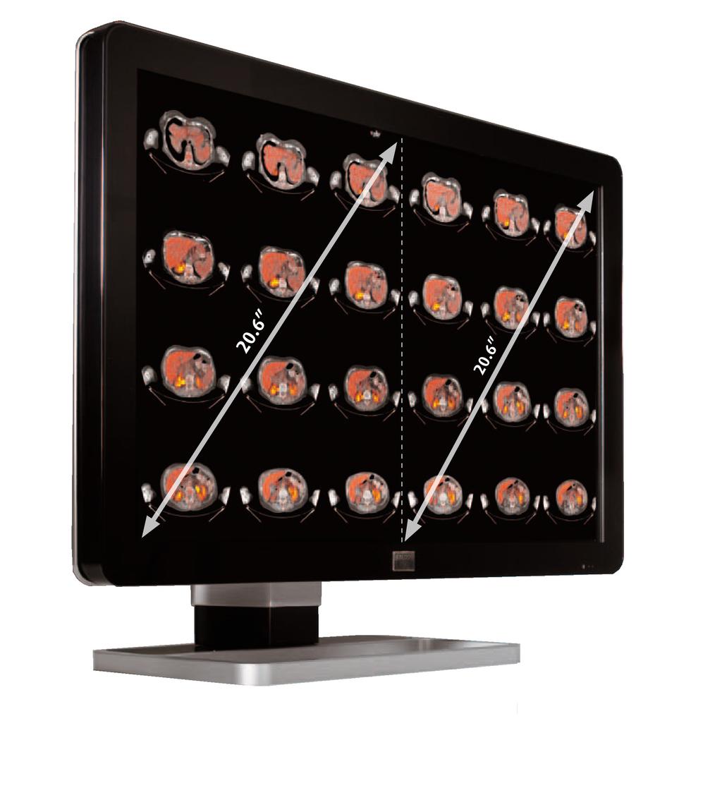 Improve Diagnostic Accuracy and Clinical Efficiency The Coronis Fusion 6MP DL is the industry s first 30-inch color LCD that can be used as two 3 megapixel heads or one seamless, wide-screen 6
