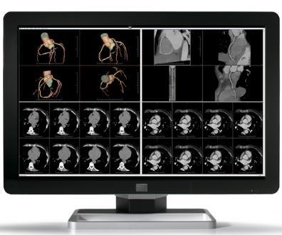 Medical images and viewing software increasingly use color to increase information density or for aid in visualization.