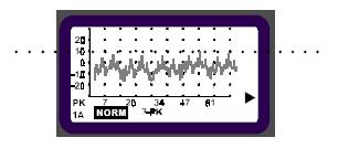 Increase Sensitivity and Range To increase the sensitivity and range of the SST in SPECTRUM Mode, simply set the reference to a LOWER level.