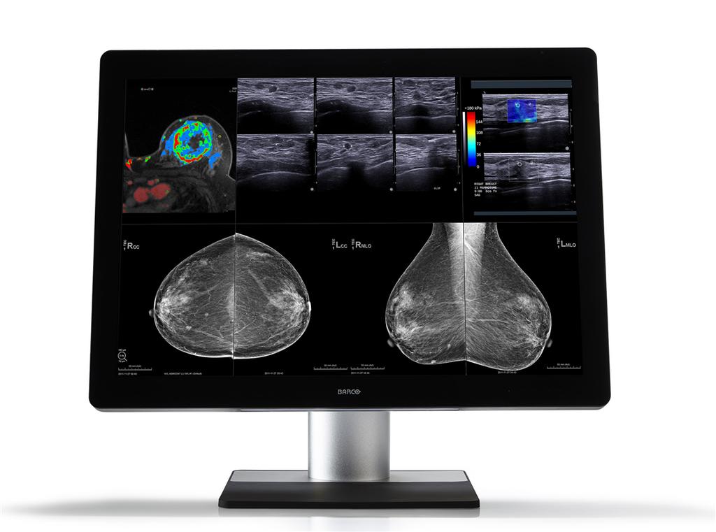 12MP diagnostic display system for PACS and breast imaging PACS and breast imaging on one display In grayscale and color (featuring unique color calibration!