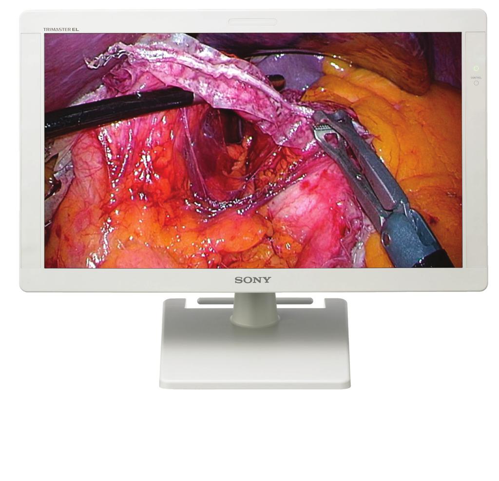 The monitor that sets your surgical sights higher. Welcome to a new realm of surgical clarity, accuracy, and brilliance.