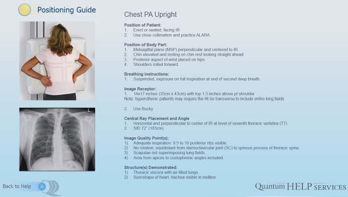 information. Positioning Guide The positioning guide includes 160 Radiographic Exams with expandable radiographs and positioning pictures for each exam.