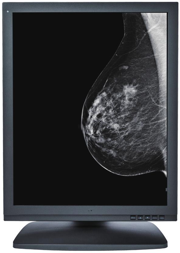 MONO 5MP 21" QSXGA Mono Mammography Display ID 390.6 The Optik View 5MP Diagnostic Monochrome Display is ideally suited for the review of Mammography images.
