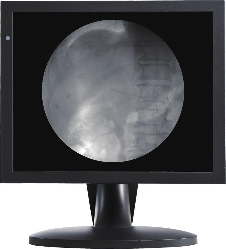 MONO 1MP 19" SXGA Mono Clinical Display ID The Optik View 1MP Clinical Monochrome Display is ideally suited for quick display and review of radiology images at the time of capture.