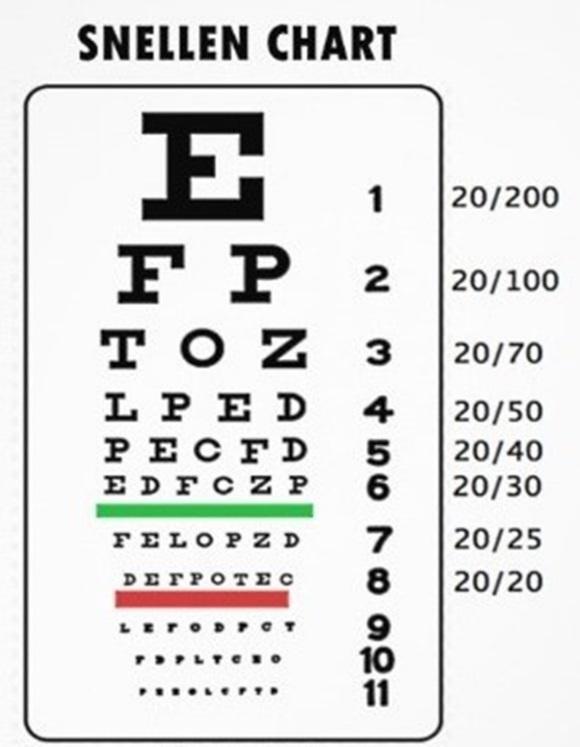 and far from optimal. Remember ophthalmologist office straining to read the last line on the Snellen vision chart?