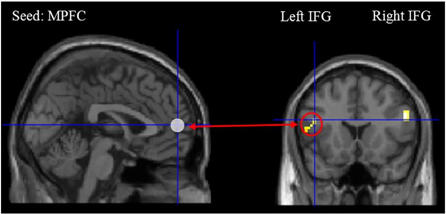 N. Spotorno et al. / NeuroImage 63 (2012) 25 39 31 Fig. 3. ROIs of the four main areas of the ToM network.