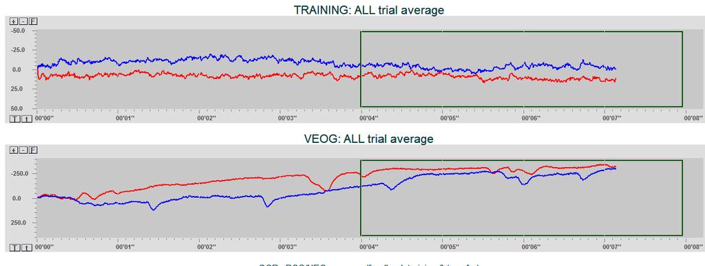 VEOG and DC-EEG correlation Since the influence of VEOG is substantial, an optional feature is a VEOG and DC-EEG correlation.