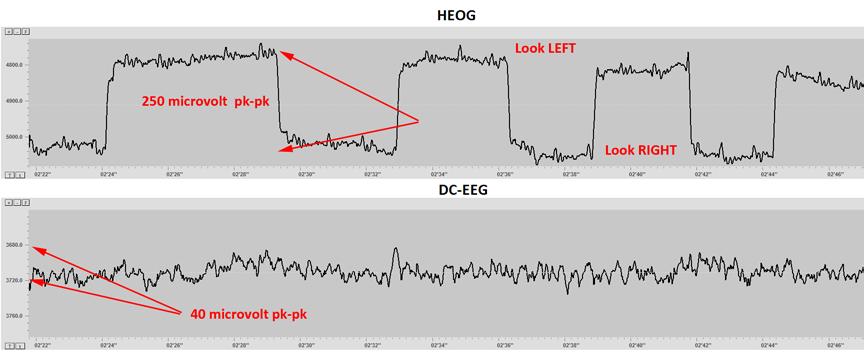 set as an extra condition to reject trials. The averaged VEOG signals for all trials can be looked at and compared to the actual training signal. The picture below shows an example of this.