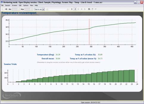 Report - Temp - Line graph and trend Report screen for sessions with 1 channel of skin conductance.