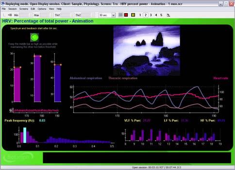 Training - HRV - % Power & Animation - 1 Monitor (or Total power) These screens are designed to up-train the low frequency (LF) band of the HRV spectrum while down-training the VLF