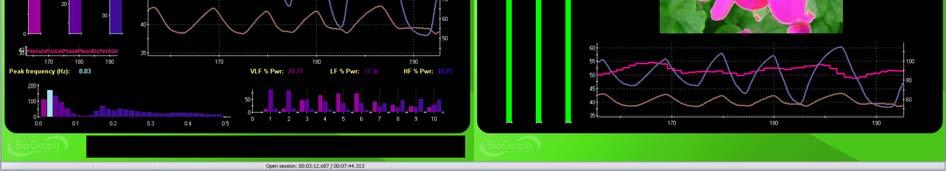 The clinician side screen shows the signal line graphs, with a trend graph of epoch means, while the client side shows simple bar graphs with the animation.