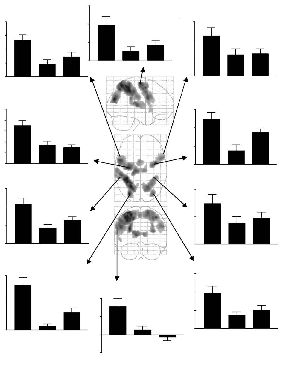 T. Hasegawa et al. / Cognitive Brain Research 20 (2004) 510 518 515 Fig. 3. Percent signal change in the well trained (Wt), less trained (Lt), and naïve (Na) groups.
