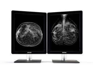 Preferred by 80% of screening centers 4 out of 5 breast screening centers choose Barco mammography display