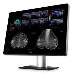 applications that require excellent grayscale rendition and detail, especially appreciated in mammography and