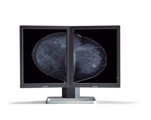 radiologist s success relies on using the most advanced display technologies available.