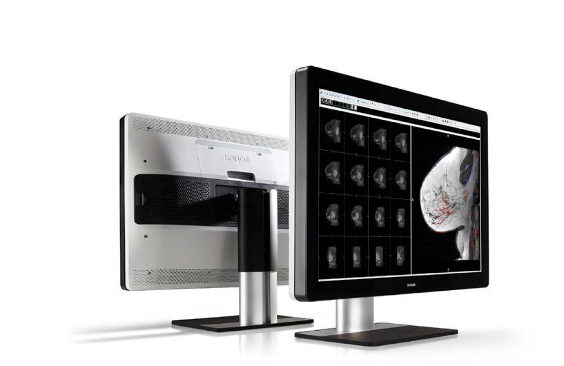 Introducing Coronis Uniti Worklist display Mammography display PACS display Big and beautiful Featuring the largest form factor today, 12 million pixels of pinpoint precision, the brightest