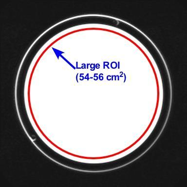 Figure 15. Image of slice 5 illustrating size and placement of the large 55 cm 2 ROI that defines the boundary inside which image uniformity measurements are made. 3.