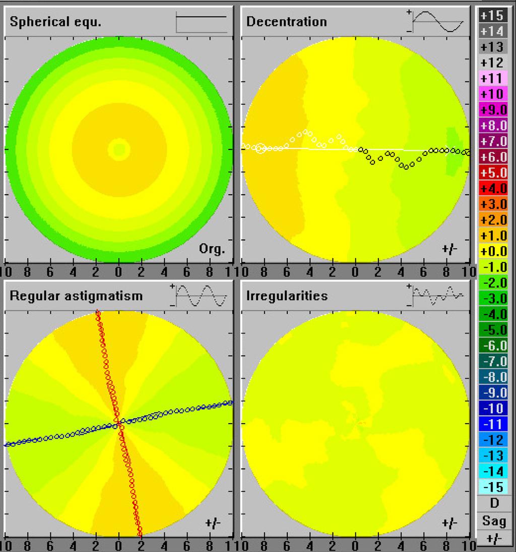 Etiology and Clinical Presentation of Astigmatism 9 Fig. 6. Fourier analysis of a normal corneal topography (mean±sd) in the right eye, 0.58±0.