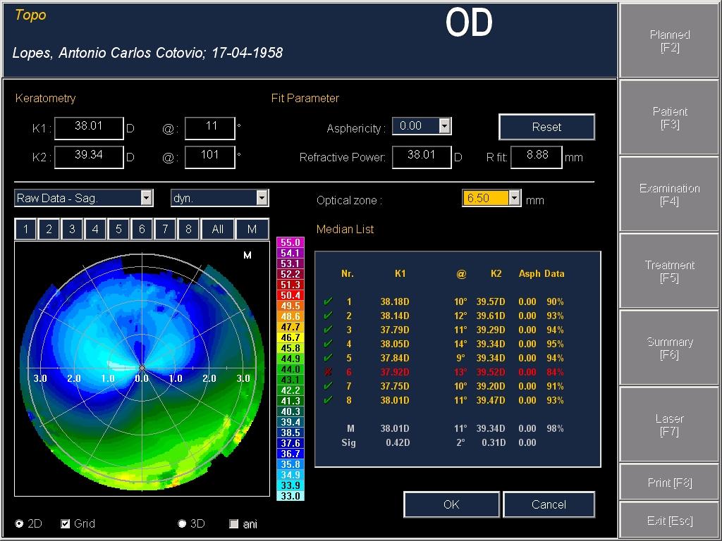 286 Diagnosis and Management of Astigmatism percentage of the data contained in the chosen optical zone (usually a 6.5mm) is displayed on the last column (Figure 12).