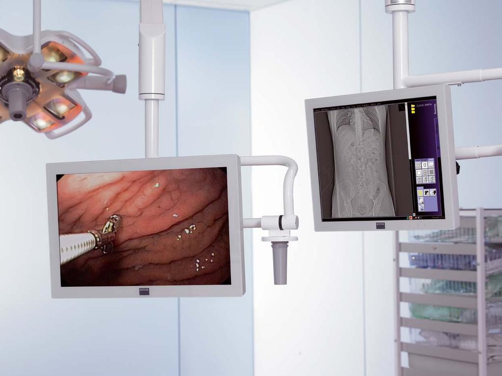 Near-patient surgical displays The complexity of general and minimally invasive surgery places high demands on technology and medical staff.