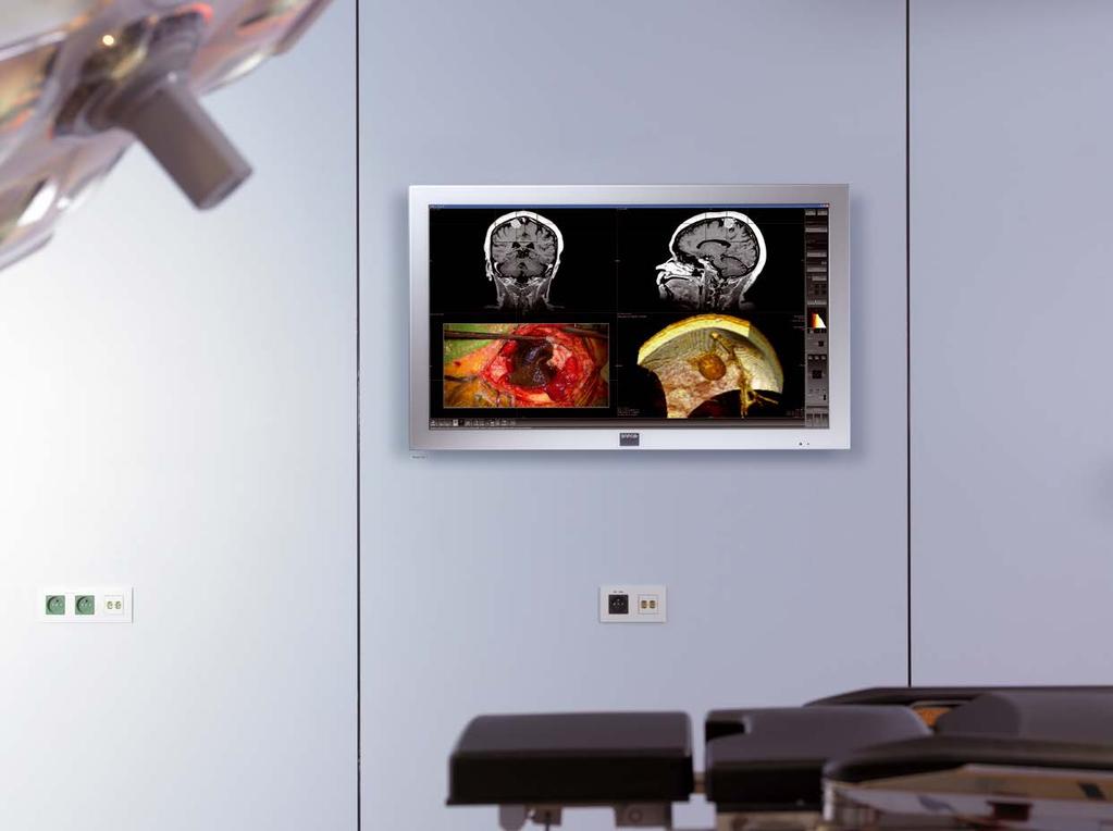 Large-screen OR displays In today s equipment-packed operating theaters, surgical teams are faced with a growing need for imaging solutions that centralize all critical information on one screen and