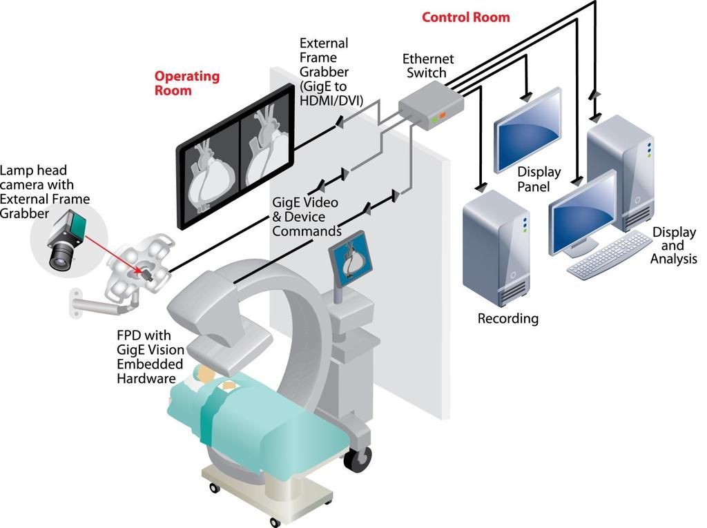 In a networked operating room (Diagram 1), a film-based X-ray panel in the C-arm has been replaced with a digital FPD.