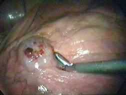3: Cryptorchidectomy Fig.