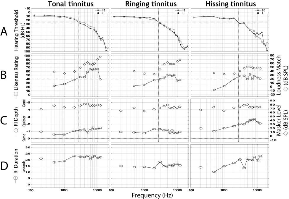 Figure 1. Averaged data are presented separately for subjects reporting tonal, ringing, or hissing tinnitus. (A) Audiogram.