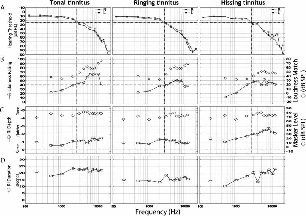 30 L.E. Roberts et al. hearing in both ears up to 8 khz but varying degrees of impairment at higher frequencies. Using sound clips in the Tinnitus Tester as examples, 43.