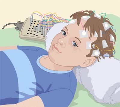 Cel mai adesea este utilizată pentru a studia formele de epilepsie dar şi de convulsii la copil, precum şi uneori modificările undelor cerebrale în cursul somnului.