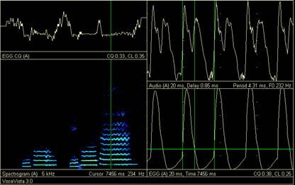 Spectrogram readings show the presence of upper frequency energy in pre-treatment samples and a