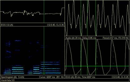 In spite of the reduction in CQ value during medium singing, spectrogram readings of both loud