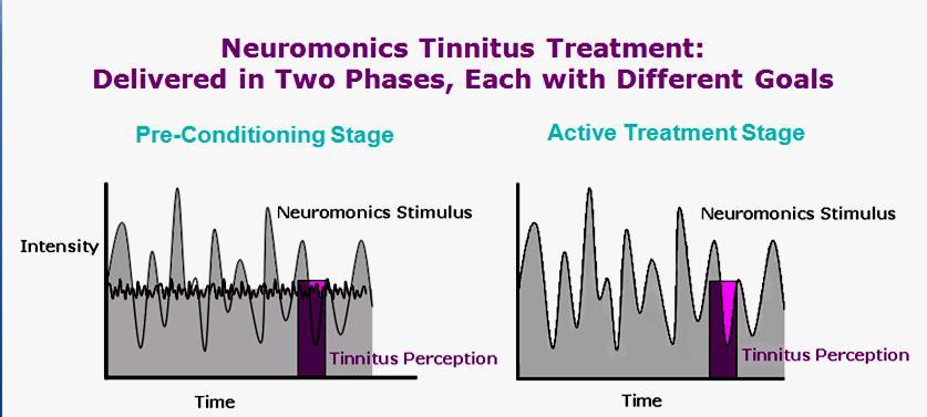 Neuromonics Tinnitus Treatment Customized for each patient s individual hearing profile Stimulation of a broad range of frequencies