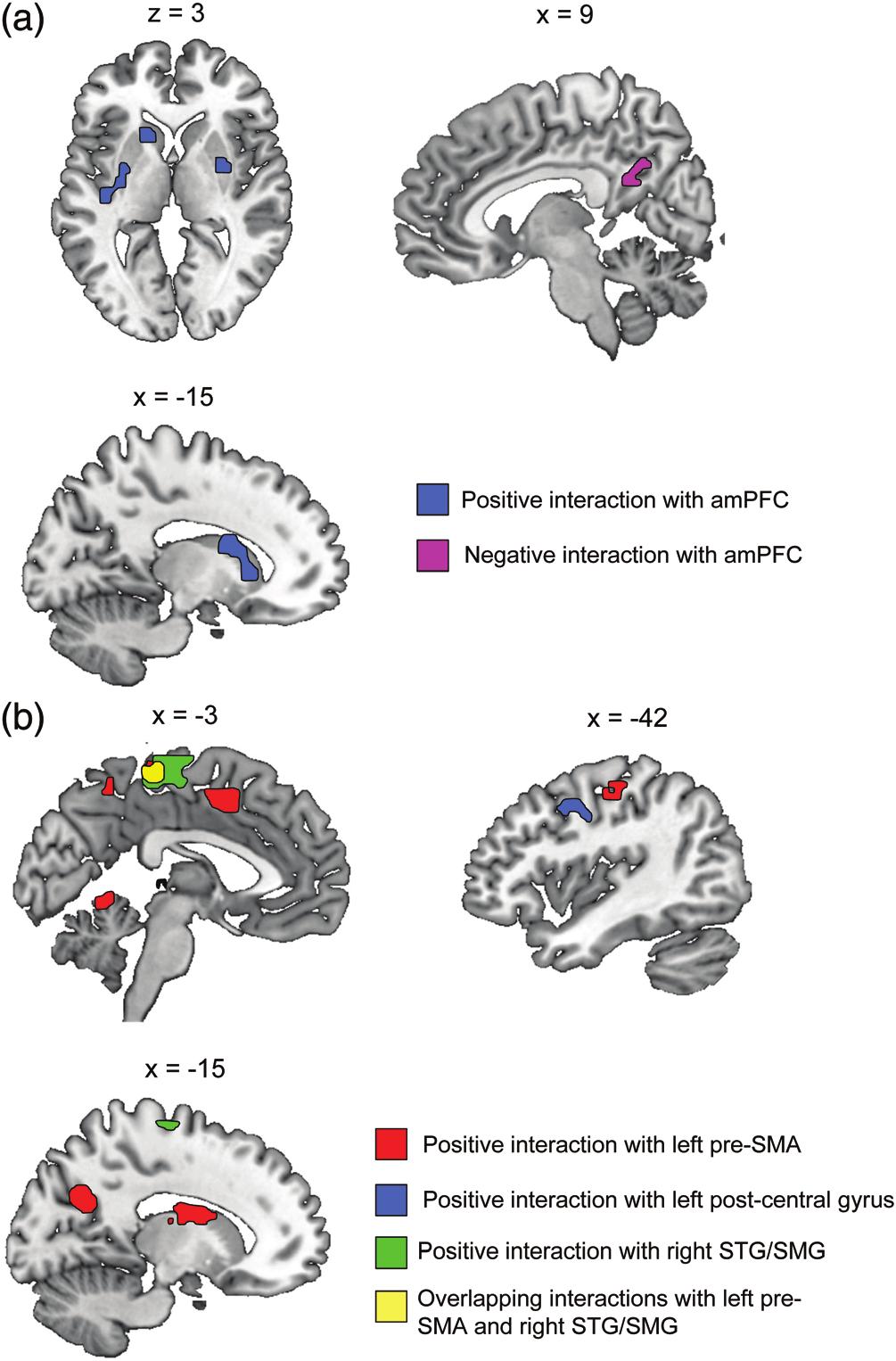 Table 4 Brain regions showing signiﬁcant positive psychophysiological interactions (PPIs) with medial prefrontal responses to laughter, dependent on the contrasts of Real > Posed and Posed > Real
