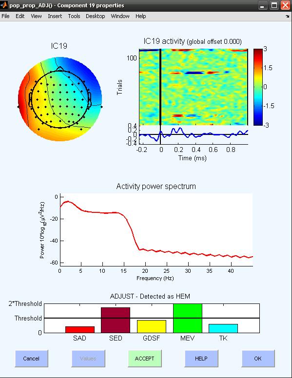 Anti-phase, primarily frontal distribution In the IC Activity by