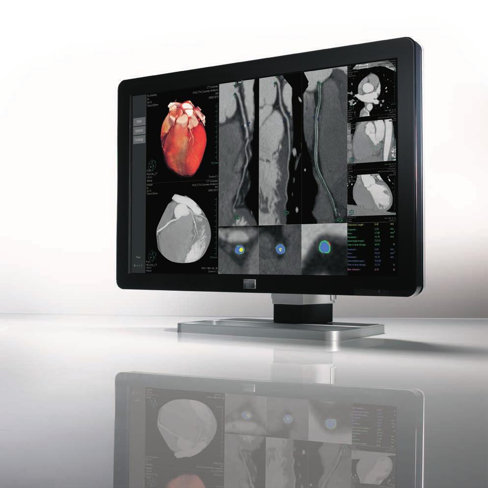 Technologies that make the difference FLEXIBILITY Flexibly organize, display and read images from various modalities on one wide-screen workstation or two bezelfree displays.