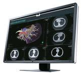 Medical Monitor Solutions Specially designed RadiForce 1- to 8-megapixel monochrome and color monitors take full account of medical institutions needs for