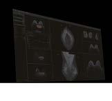 the Ideal Mode for Modalities The EIZO-patented drift