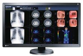 The RadiForce RX850 s 8MP high-resolution screen also displays digital mammography images in exceptional detail.